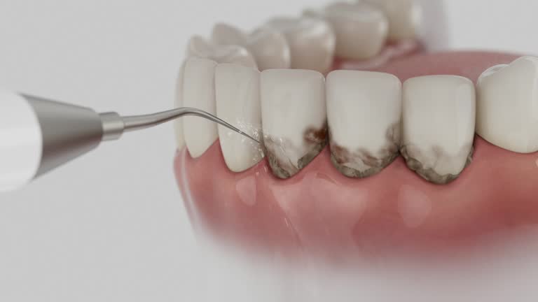 Trusted Teeth Cleaning And Checkup service in Maxton, NC - Dentist Open Now